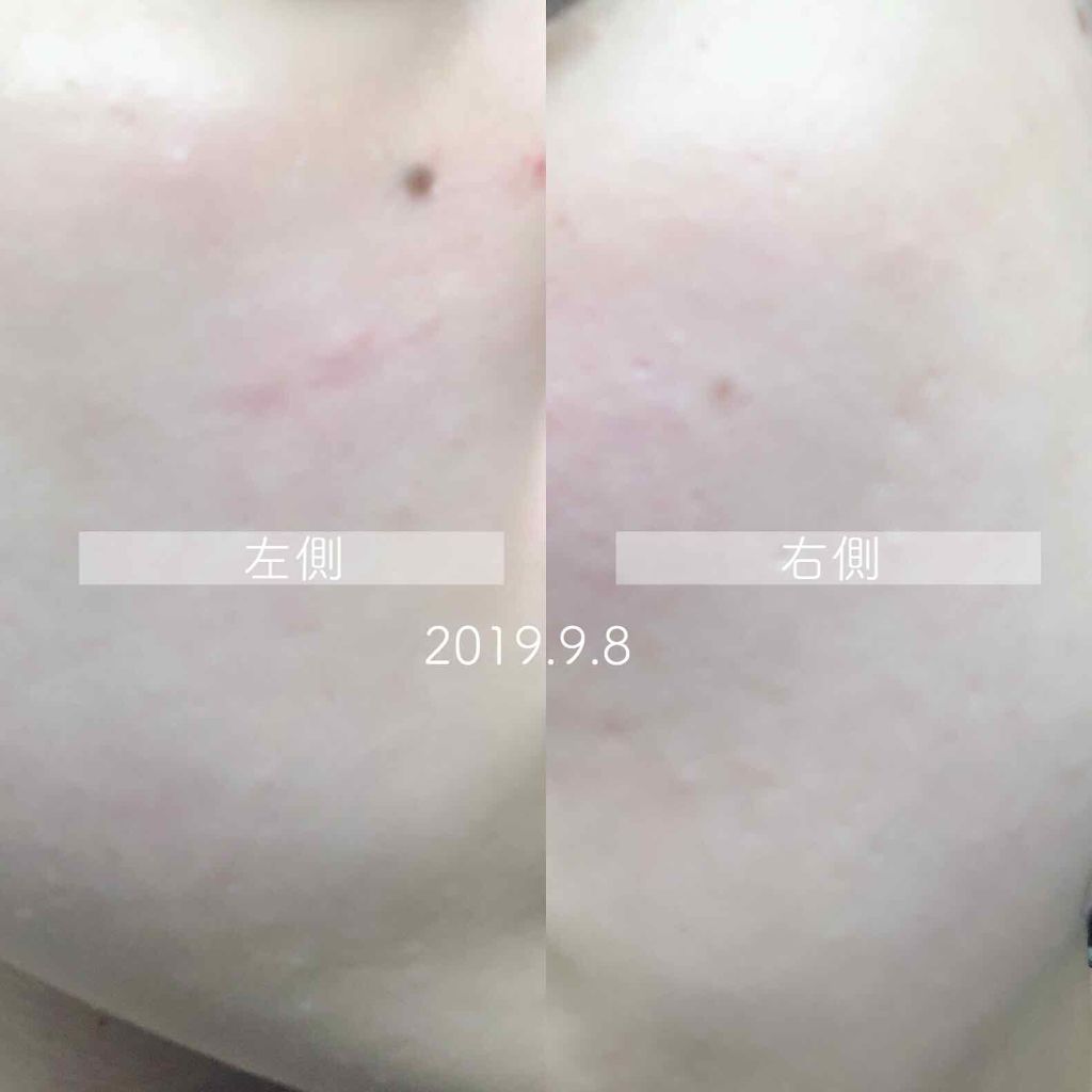 艶肌ドロップ/ラッシュ/美容液を使ったクチコミ（3枚目）