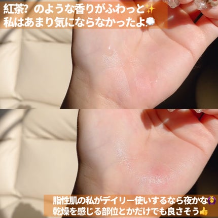 Kombuchaブラックティー90トリートメントエッセンス/ネイチャーリパブリック/化粧水を使ったクチコミ(4枚目)