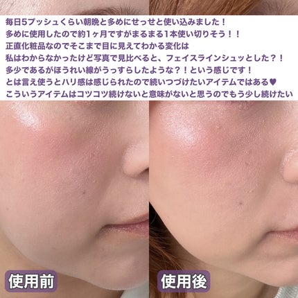 9番 NMNバイオリフト濃縮美容液/numbuzin/美容液を使ったクチコミ(5枚目)