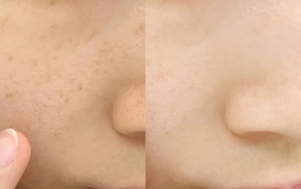 TXトラネキグルタショット/CELLINSHOT/美容液を使ったクチコミ（2枚目）