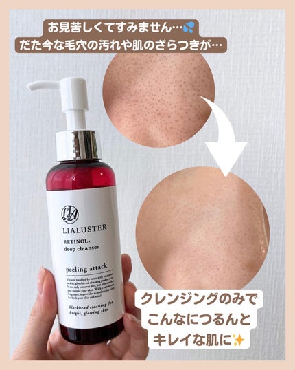 アラサー美容マニア | 化粧品検定1級 on LIPS 「@stay.b_ ◀︎アラサーおすすめコスメはこちら!\角質ケ..」(6枚目)