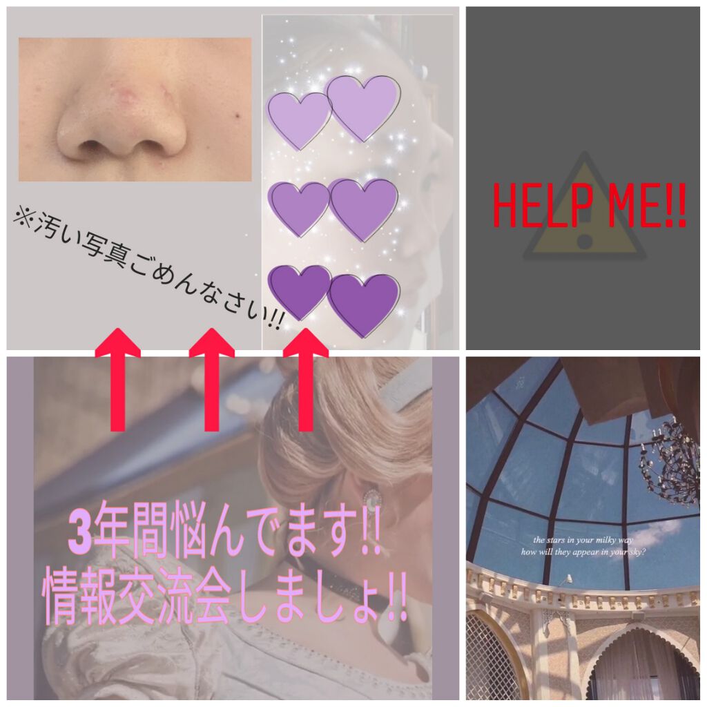 オードムーゲ 薬用ローション（ふきとり化粧水）/オードムーゲ/拭き取り化粧水を使ったクチコミ（1枚目）