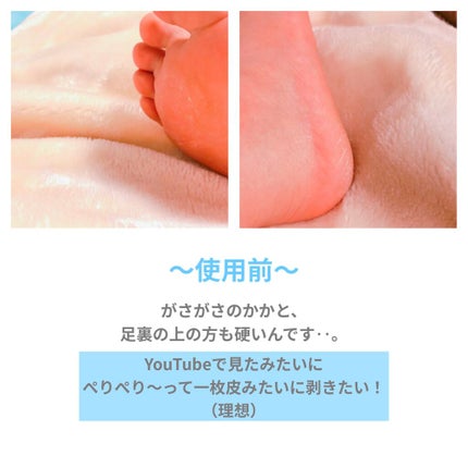 イージーパックDP60分タイプ/ベビーフット/レッグ・フットケアを使ったクチコミ(3枚目)