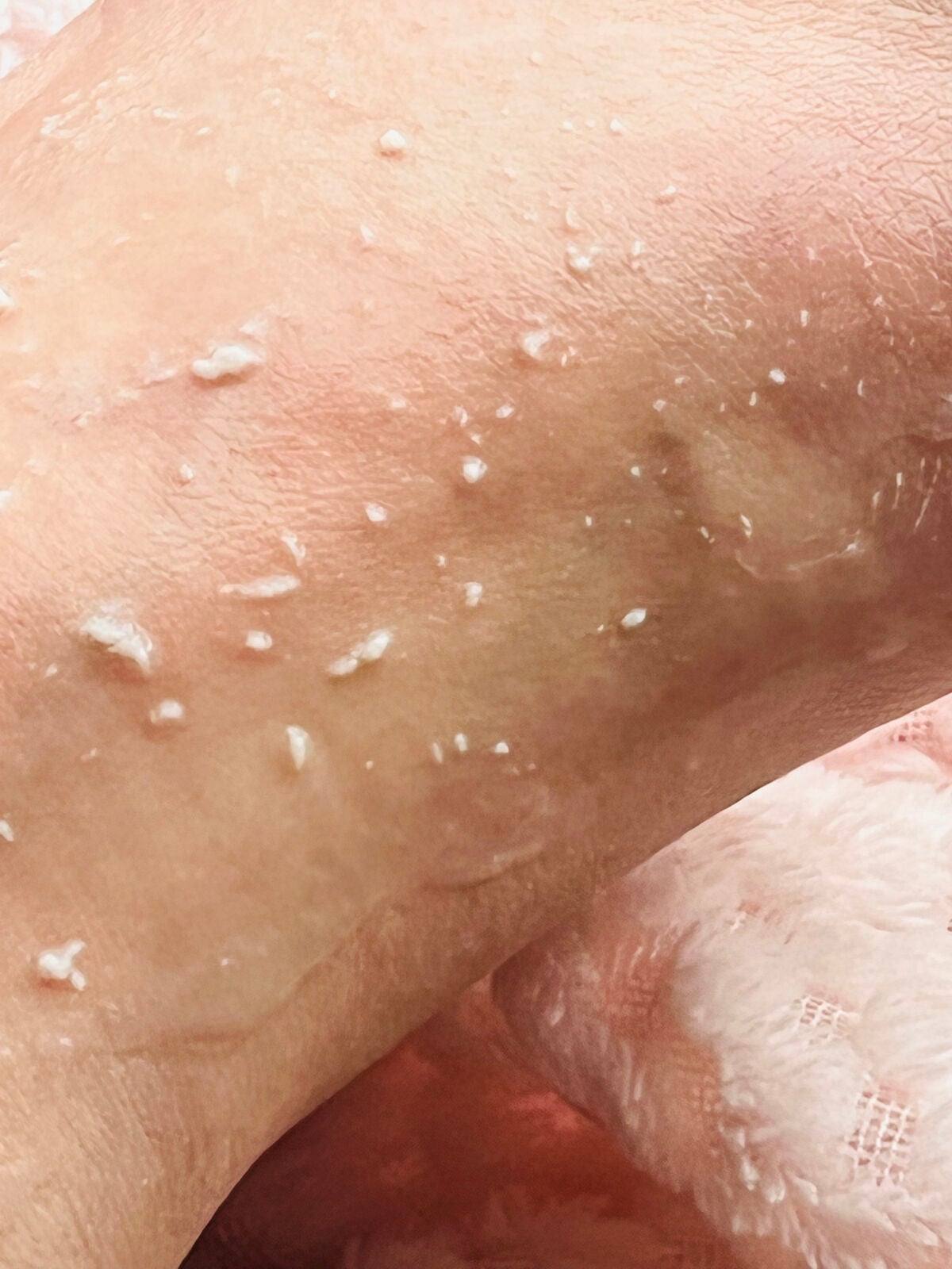 美白乃美人ピーリングジェル/ブレーンコスモス/ピーリングを使ったクチコミ(5枚目)