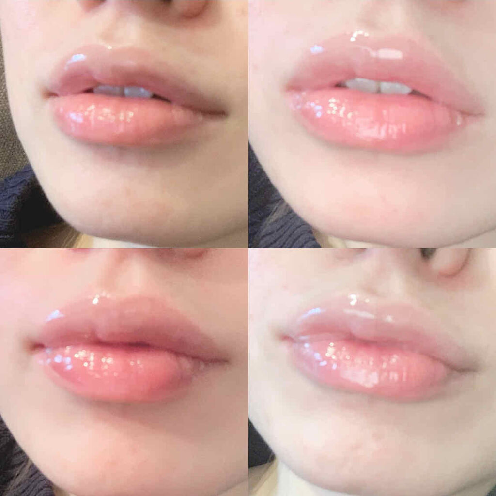 薬用リップエッセンス a/ettusais/リップケアを使ったクチコミ（3枚目）