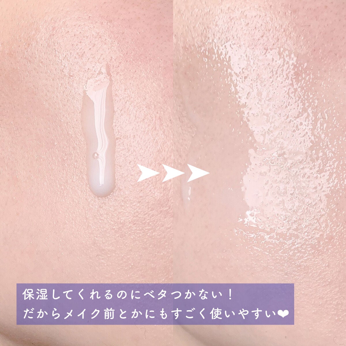 バリアダームミルキーセラム/SKIN&LAB/美容液を使ったクチコミ(3枚目)