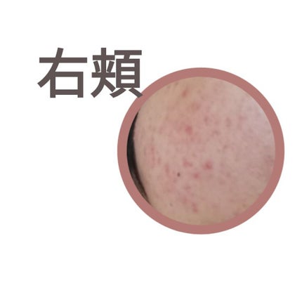 ハトムギ化粧水(ナチュリエ スキンコンディショナー R )/ナチュリエ/化粧水を使ったクチコミ(2枚目)