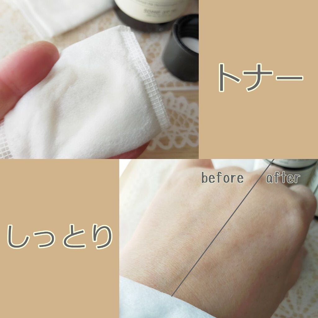 ガラクトミセスピュアビタミンCグロートナー/SOME BY MI/化粧水を使ったクチコミ(2枚目)