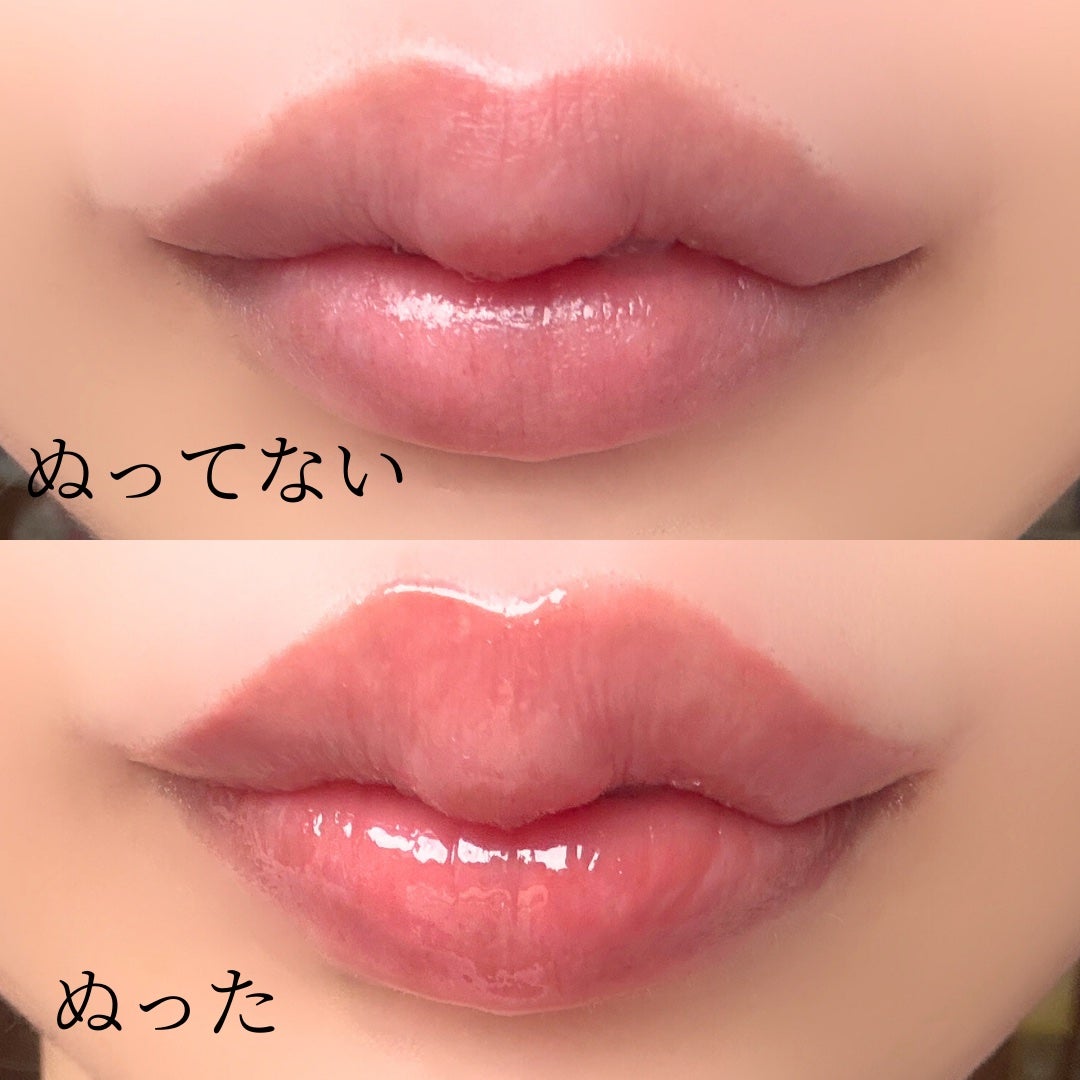 ニードルプランパー 高熱フィグ/Ui2./リッププランパーを使ったクチコミ(3枚目)