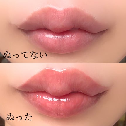 ニードルプランパー 高熱フィグ/Ui2./リッププランパーを使ったクチコミ(3枚目)