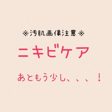 なぜかそこにだけある【顎ニキビ】

今年に入ってから急に増え出し、職場でも「体調大丈夫？」「ストレス抱えてるんじゃない？」と心配されるほど。

彼氏にスッピンなんて、本当は見せたくない😢

ということで