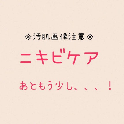 ペアアクネクリームW(医薬品)/ペア/その他を使ったクチコミ(1枚目)