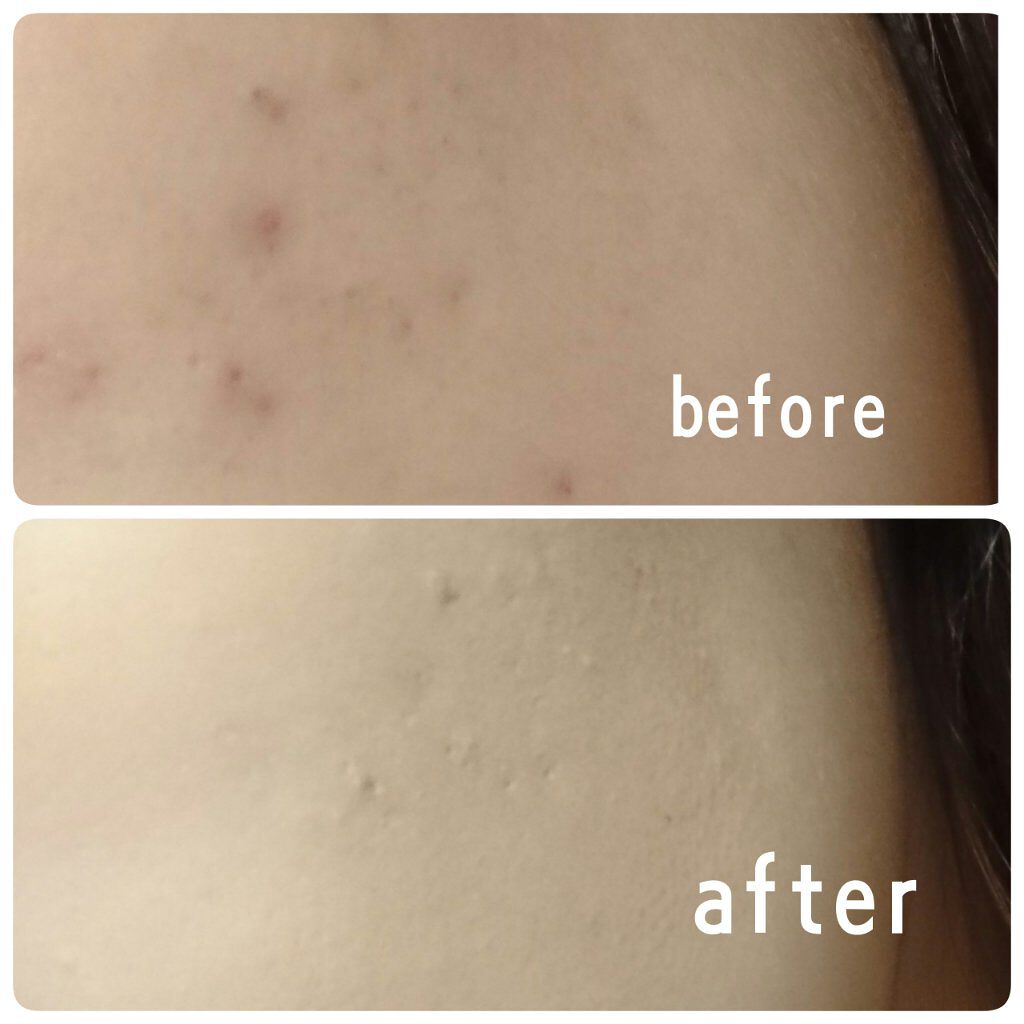 カバーパーフェクション チップコンシーラー/the SAEM/リキッドコンシーラーを使ったクチコミ(3枚目)