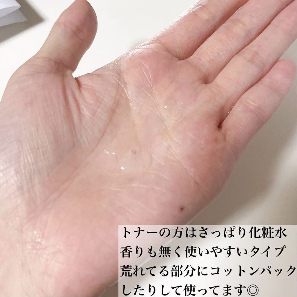 ドクダミ 77 スージングトナー/Anua/化粧水を使ったクチコミ（2枚目）
