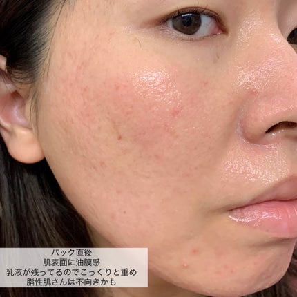 小豆島ルルルン オリーブマスク/ルルルン/シートマスク・パックを使ったクチコミ(6枚目)