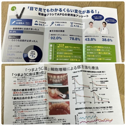電動歯ブラシTAPG/TAPG/歯ブラシを使ったクチコミ(5枚目)