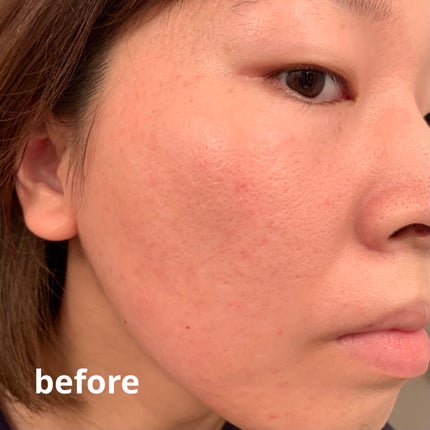 ãã³ã¯ãã£ãŒããªãŒã«ããŒã¯ãã·ã§ã³/APLIN/ã¯ãã·ã§ã³ãã¡ã³ããŒã·ã§ã³ã䜿ã£ãã¯ãã³ãïŒ5æç®ïŒ