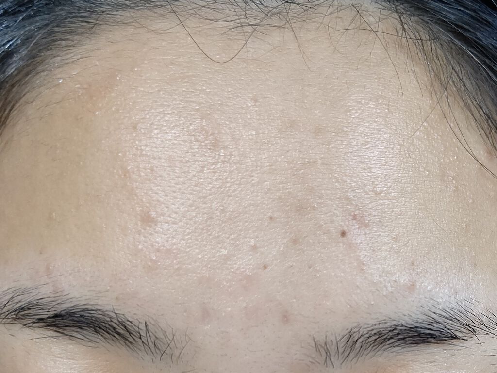 ロゼットゴマージュ/ロゼット/ピーリングを使ったクチコミ(2枚目)