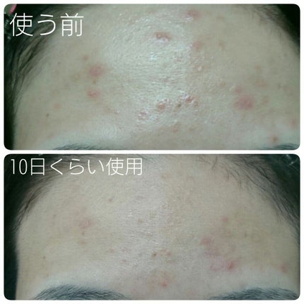 マイルド&モイスチャーアロエジェル/ネイチャーリパブリック/ボディローションを使ったクチコミ(3枚目)