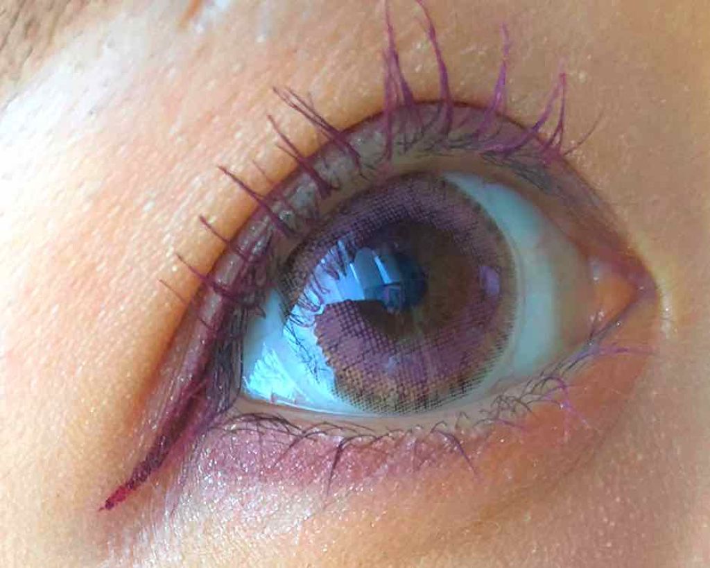 オードムーゲ 薬用ローション(ふきとり化粧水)/オードムーゲ/拭き取り化粧水を使ったクチコミ(2枚目)