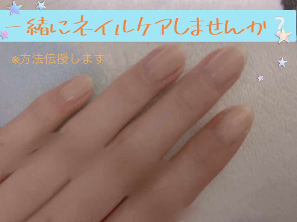 ウィンマックス キューティクルオイル/DAISO/ネイルオイル・トリートメントを使ったクチコミ(1枚目)
