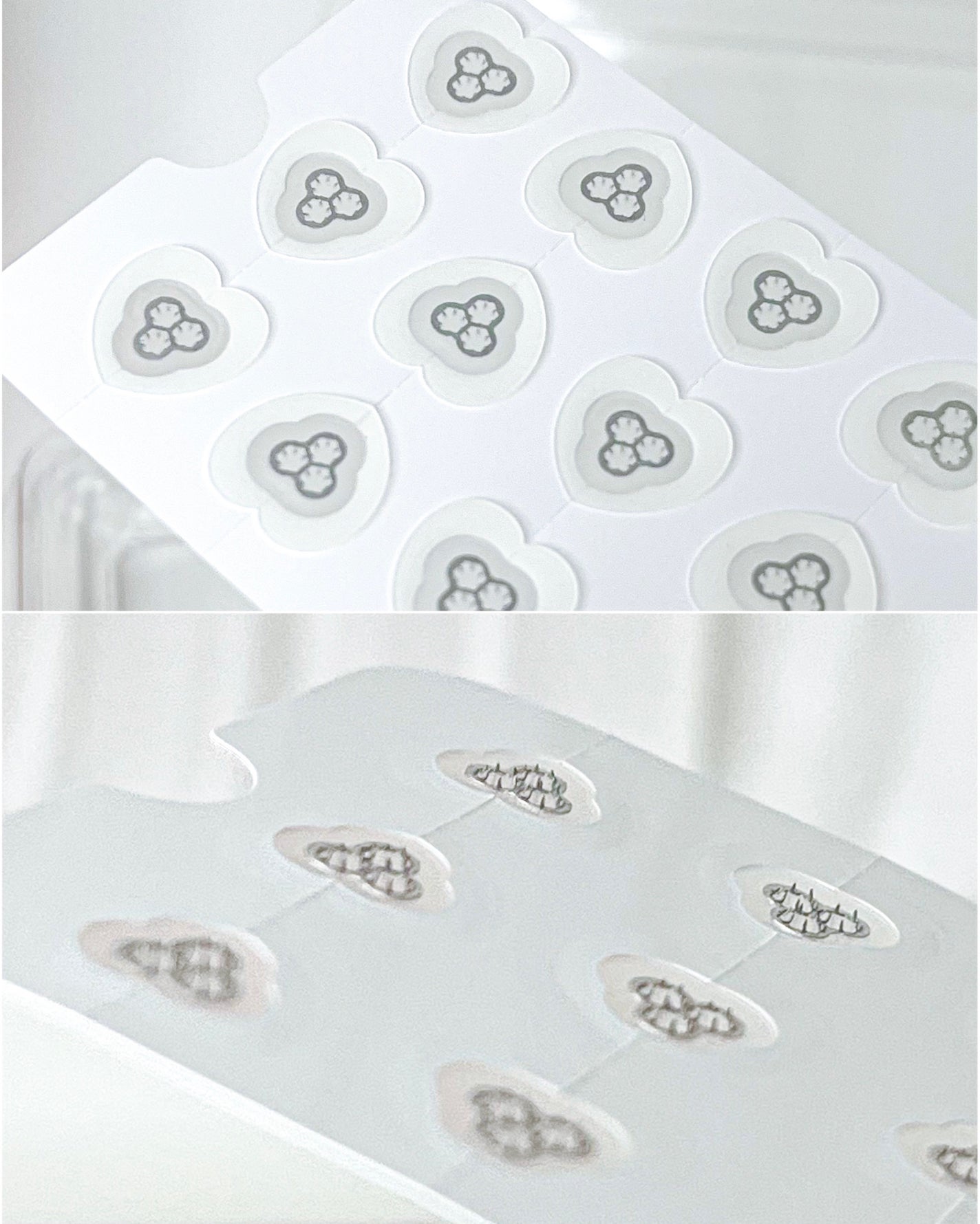 ACマグネシウムパッチ ミニ/スノーツープラス/にきびパッチを使ったクチコミ(2枚目)