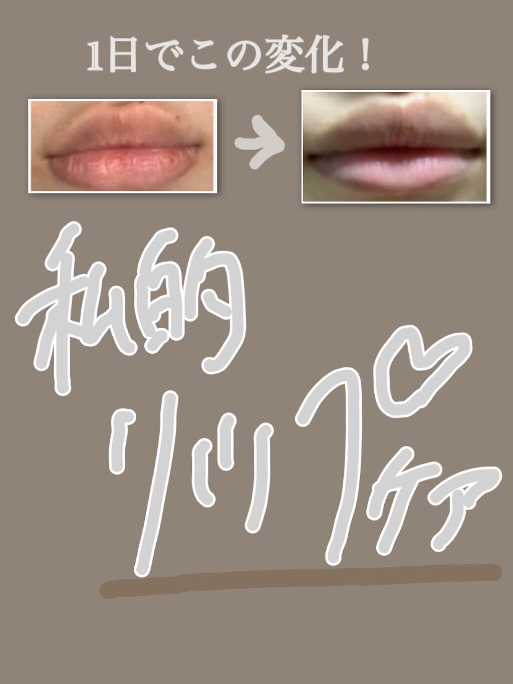 リップスリーピングマスク/LANEIGE/リップバームを使ったクチコミ(1枚目)