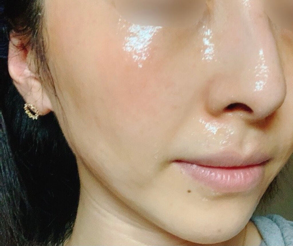 リアルカレンデュラピールオフパック/APRILSKIN/ピーリングを使ったクチコミ(2枚目)