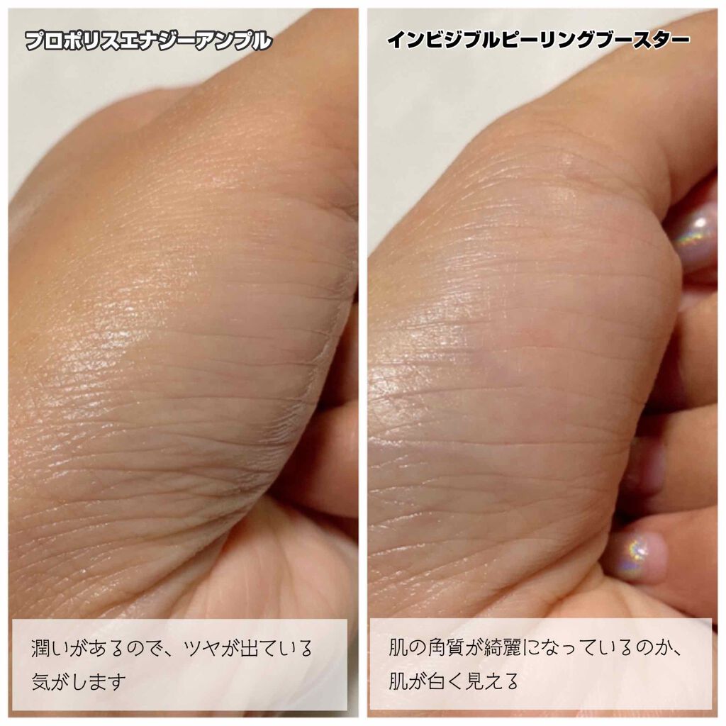 インビジブルピーリングブースターエッセンス/CNP Laboratory/ブースター・導入液を使ったクチコミ(4枚目)