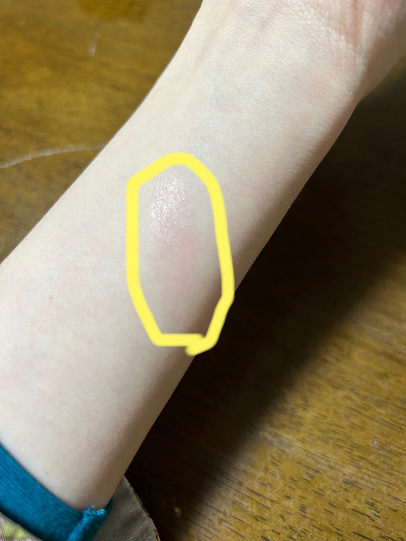 ローズ・パーフェクト/GIVENCHY/リップバームを使ったクチコミ(8枚目)