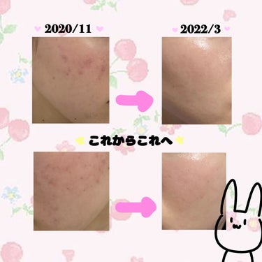 薬用しみ対策 美白化粧水 しっとりタイプ/メラノCC/化粧水を使ったクチコミ（1枚目）