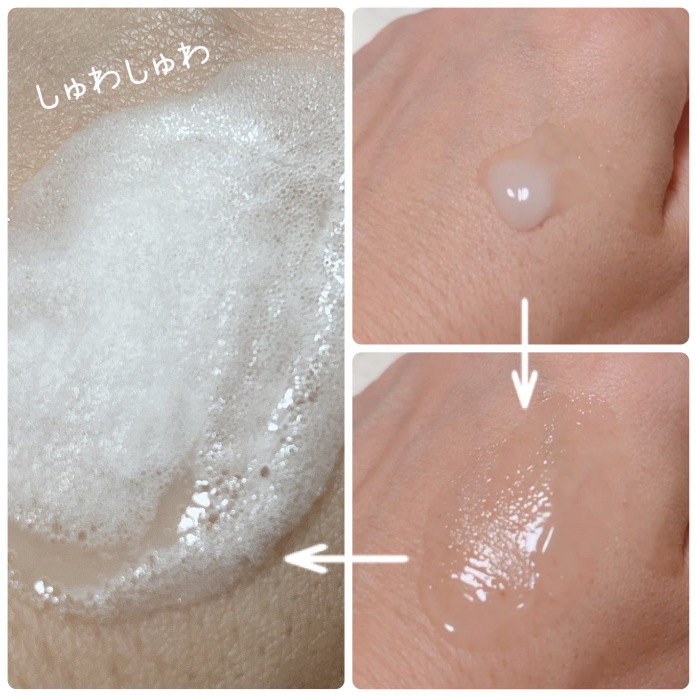 スパークリングスカルプスケーラー/ミンツリー/頭皮ケアを使ったクチコミ(3枚目)