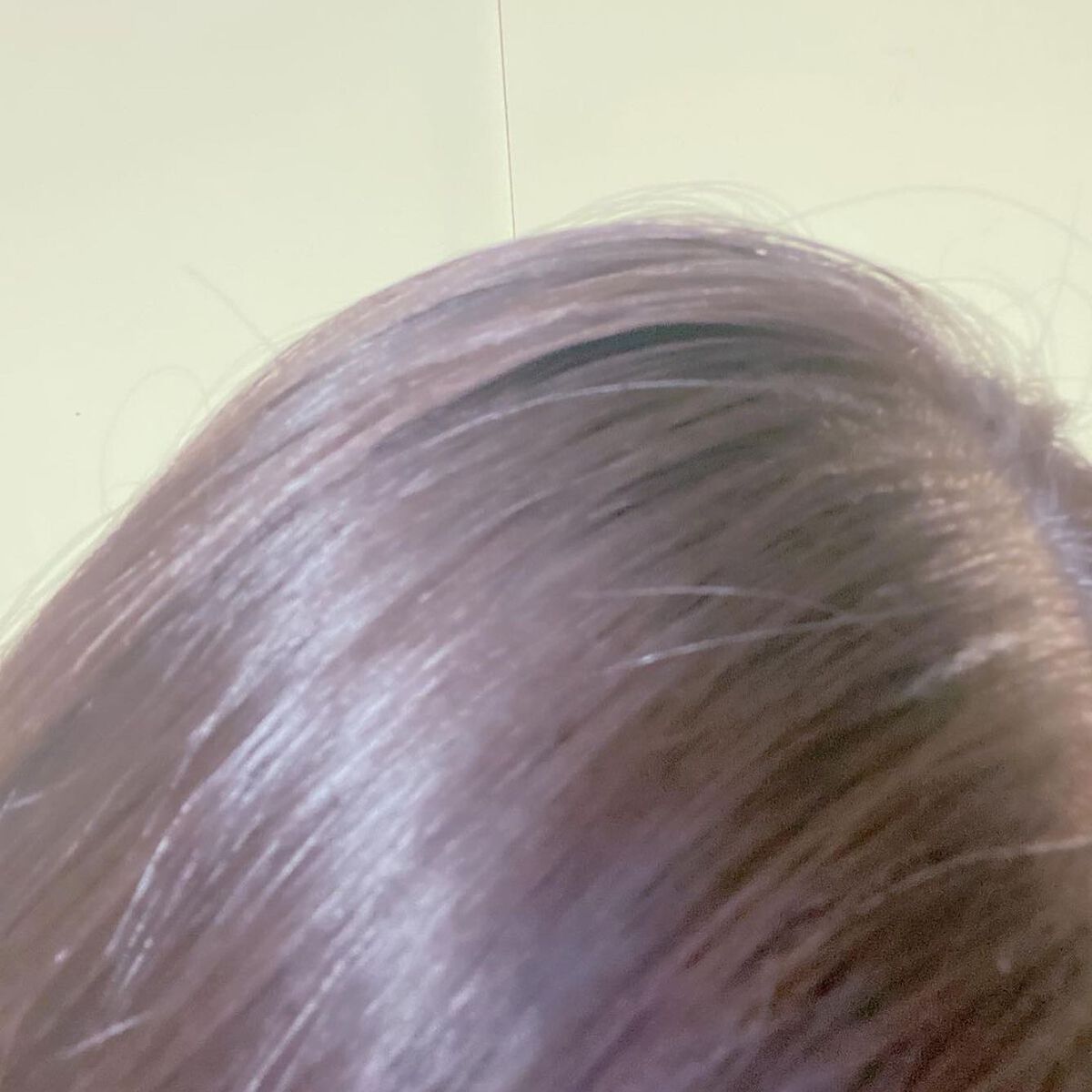 Wアプローチヘアプログラム/MUNOAGE(ミューノアージュ)/頭皮ローションを使ったクチコミ(9枚目)