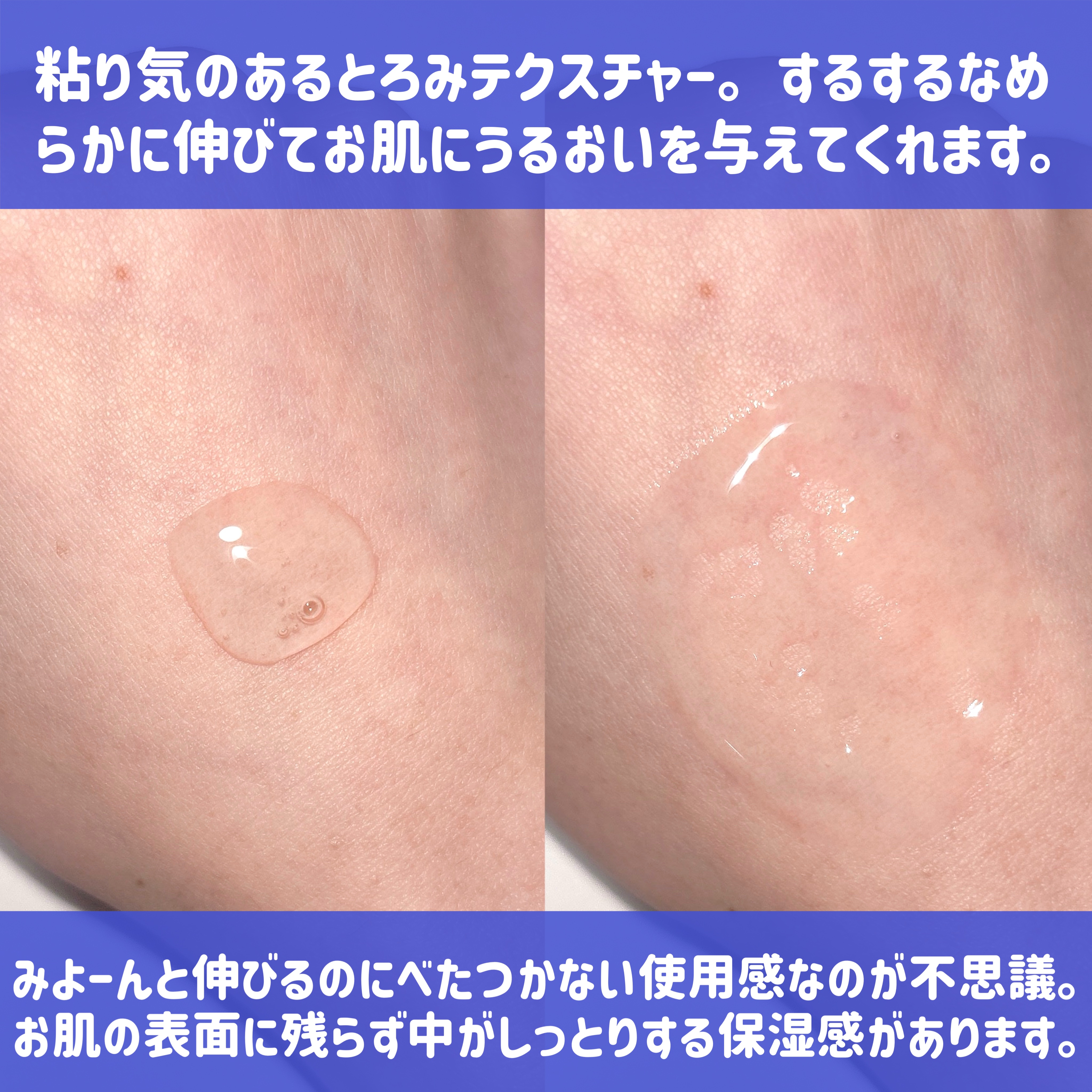 グルカミューンクリーム/VT/フェイスクリームを使ったクチコミ（3枚目）