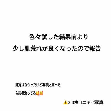 HH on LIPS 「前に比べて少しニキビ跡が減ってる気がする！前回の写真は前の投稿..」（1枚目）