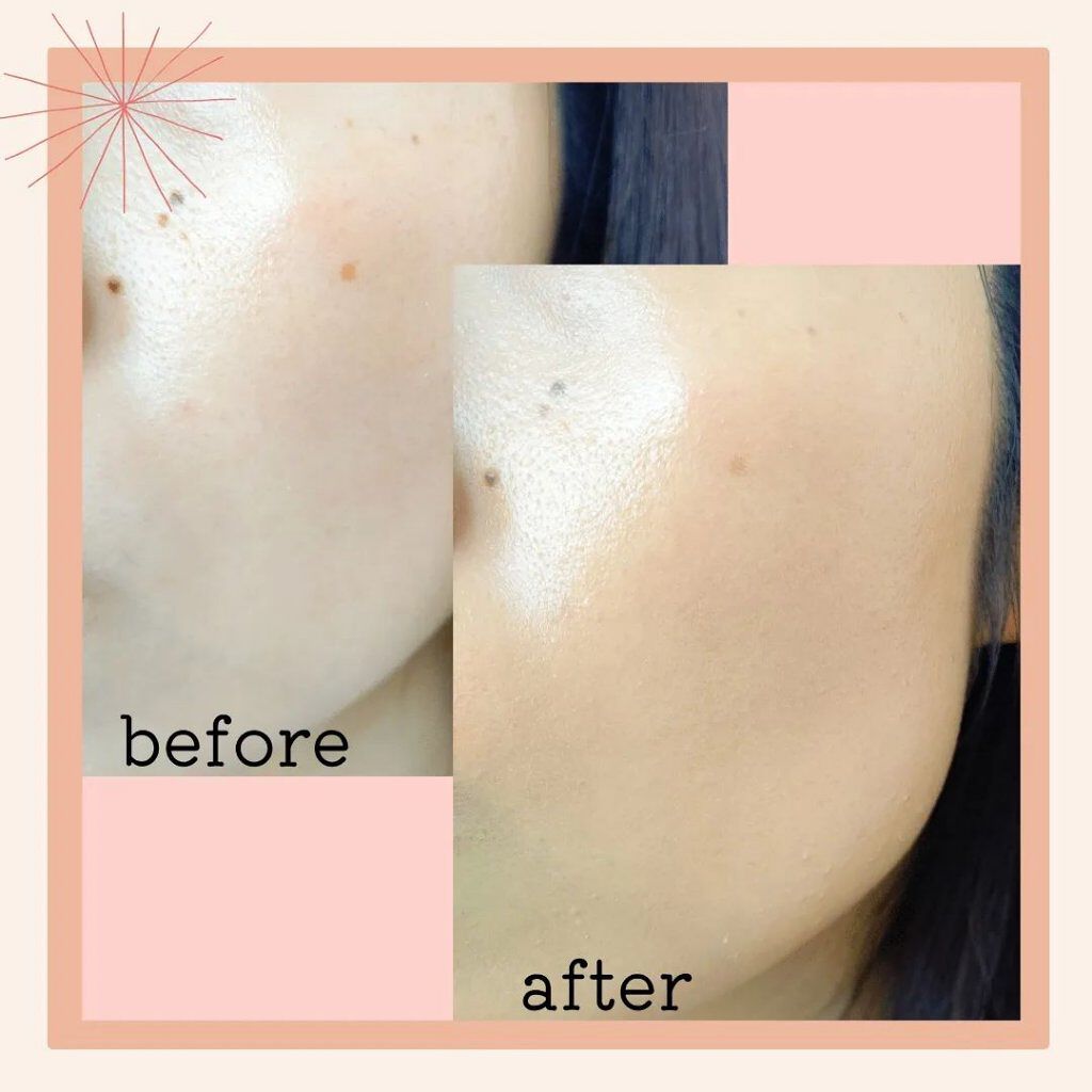 を使ったクチコミ（3枚目）