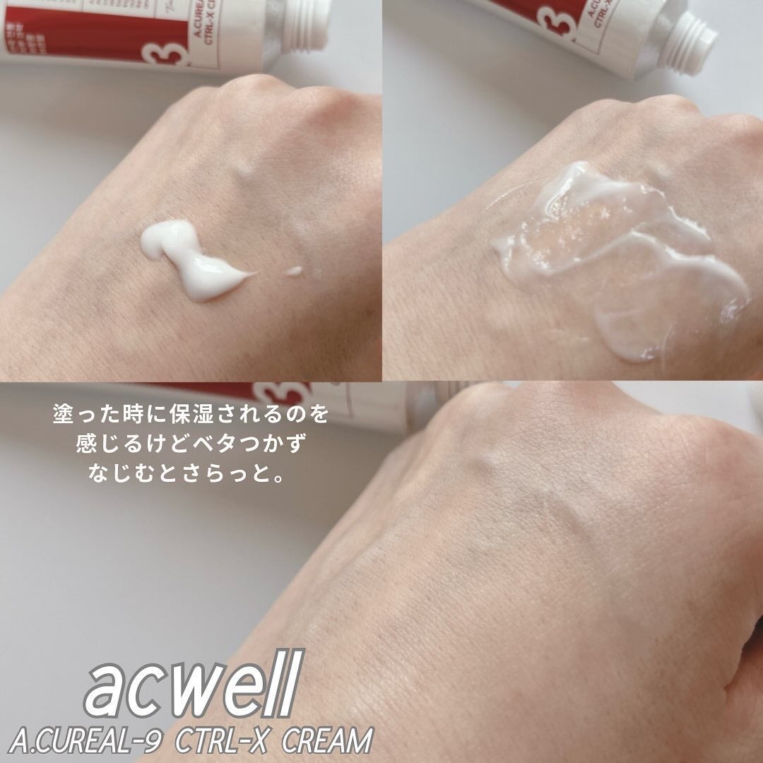 アキュリアルナインコントロールエックスクリーム/ACWELL/フェイスクリームを使ったクチコミ(7枚目)