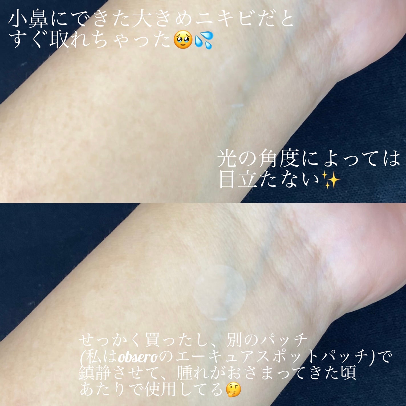 ごめんね素肌 キニシナイパッチ/クリアターン/シートマスク・パックを使ったクチコミ(3枚目)