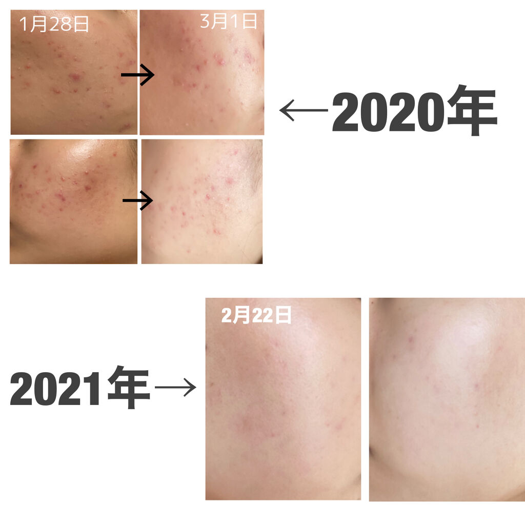 を使ったクチコミ（2枚目）