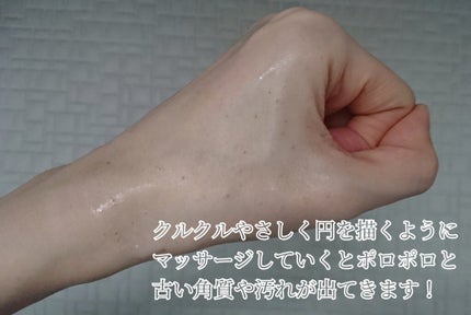 ひざピーリングジェル/コヒザドール/レッグ・フットケアを使ったクチコミ(6枚目)