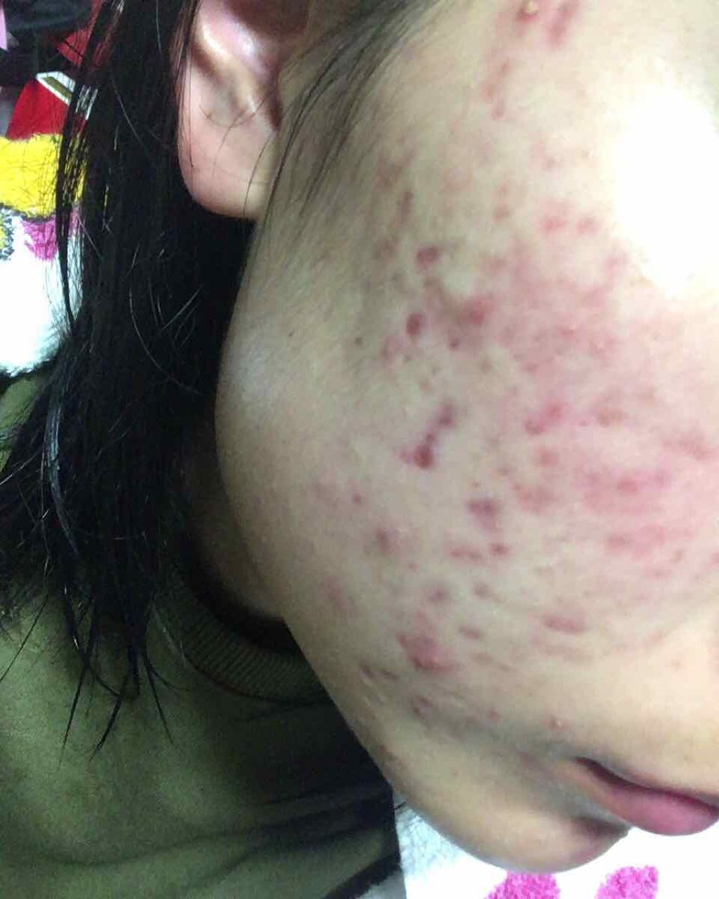 7 day Special Set プログラム3/b.glen/トライアルキットを使ったクチコミ(3枚目)