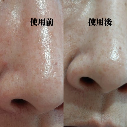 リードルショット100/VT/美容液を使ったクチコミ(4枚目)