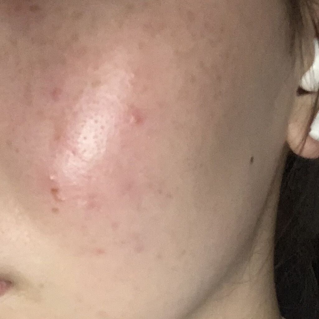 白潤 薬用美白化粧水(しっとりタイプ)/肌ラボ/化粧水を使ったクチコミ（1枚目）