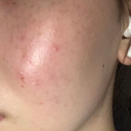 乳液・敏感肌用・高保湿タイプ/無印良品/乳液を使ったクチコミ(1枚目)