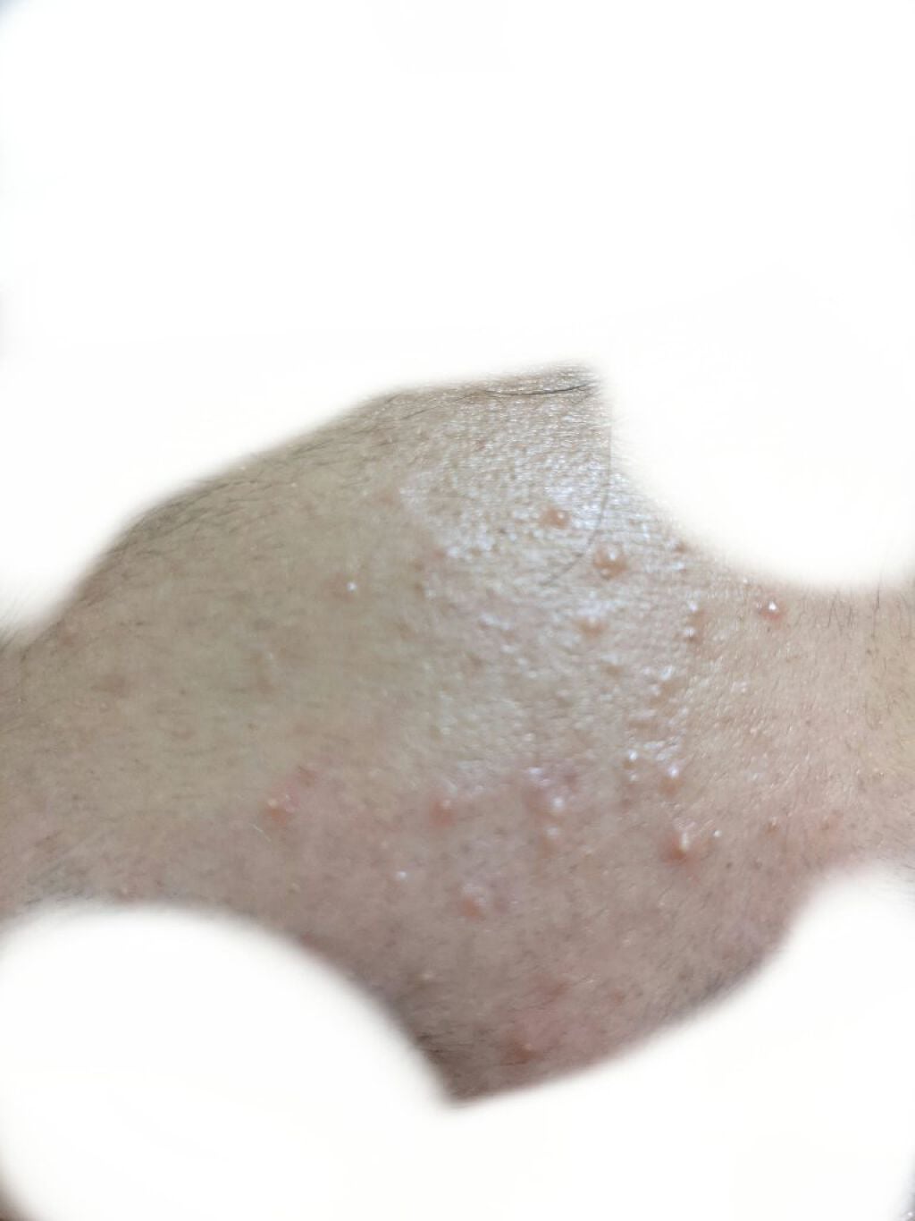 いやりんぐ on LIPS 「学校帰りの肌です。朝は「お!調子いいじゃん?」って思っても学校..」(2枚目)