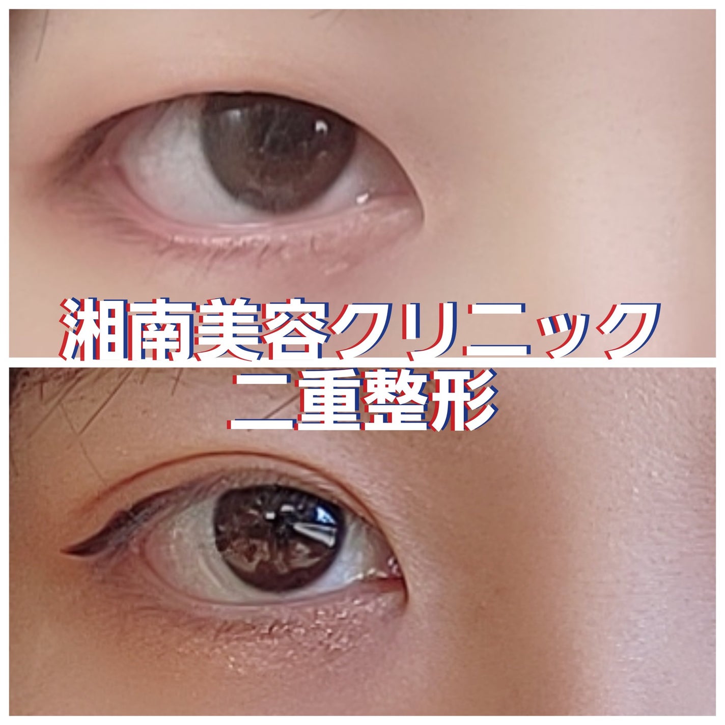 ÐïhÐŸðŠŠ on LIPS ãæ¹åçŸå®¹ã¯ãªããã¯ã§äºéæŽåœ¢çãŸããŠãããã£ã£ã£ã£ã£ãšäžéã§ç..ãïŒ1æç®ïŒ