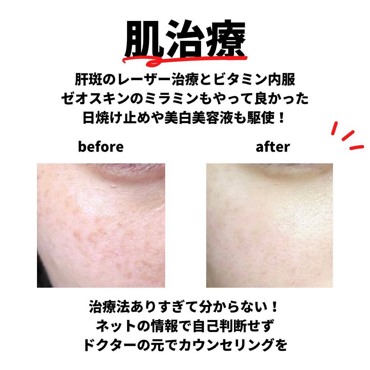 oto|好きを育てるメイクレシピ on LIPS 「垢抜けるために必要なのは「自分に合うものを見つけること」だと思..」(4枚目)