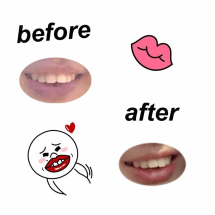 DHC 薬用リップクリーム/DHC/リップクリームを使ったクチコミ(2枚目)