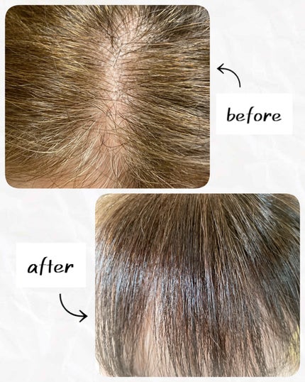 オイルパックカラー/ビゲン/ヘアカラーを使ったクチコミ(5枚目)