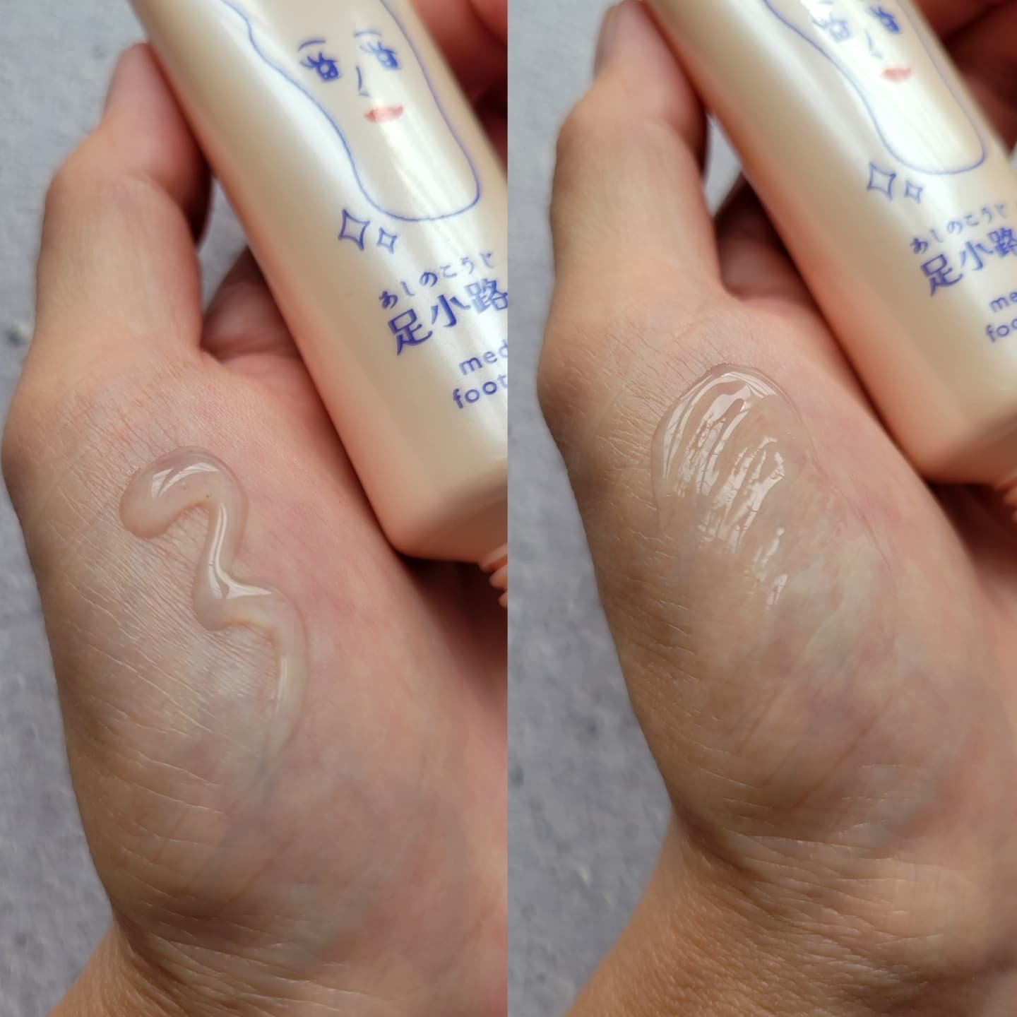 足小路麗子 薬用 フットケアジェル/ナリスアップ/レッグ・フットケアを使ったクチコミ（2枚目）